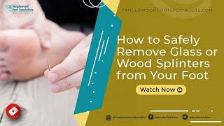 How to Safely Remove Glass or Wood Splinters from Your Foot [upl. by Hudson]