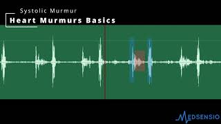 Systolic Heart Murmur from a Patient with Aortic Stenosis [upl. by Weider555]