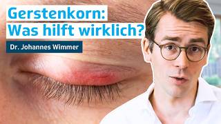 Tipps gegen Gerstenkorn Ursache Symptome amp Behandlung  Dr Johannes Wimmer [upl. by Ybhsa]