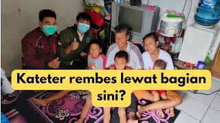 kateter rembes lewat sini [upl. by Suedaht]