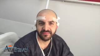 Trapianto capelli Risultato e testimonianza Aratravel Dr Aygin [upl. by Horwitz]