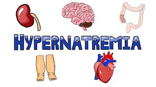 An Approach to Hypernatremia  Hypernatremia Diagnostic Algorithm  Hypernatremia Causes MADE EASY [upl. by Wurster]