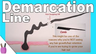 What Is Demarcation Line  Point For Hair  And Breakage [upl. by Ulphia]