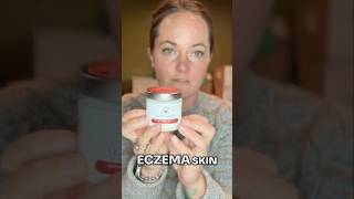 Is This Crème the Solution for Dry Eczema skin [upl. by Bakemeier]