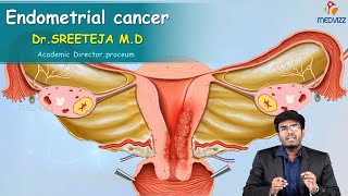 Endometrial Cancer  Obstetrics and gynaecology Video lectures Version 20  Medvizz app [upl. by Henn]