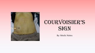 Courvoisiers sign pathophysiology Courvoisiers law [upl. by Pillow818]