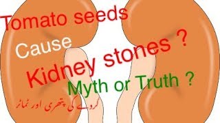 TOMATO SEEDS CAUSE KIDNEY STONES TRUTH OR MYTH URDUHINDI [upl. by Onirefez]