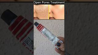 Open pores removal best cream retino a cream remove open pores skincare shortsvideo [upl. by Nyrem298]