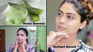 How To Do Aloe Vera Facial For Clear Glowing And spotless Skin  Rinkal Soni [upl. by Gilliette]