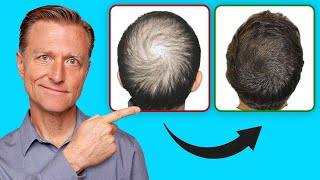 How to Help Regrow Your Hair UPDATED VITAL INFO [upl. by Kenji]