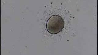 fertilization of sanddollar eggs [upl. by Ynafetse]