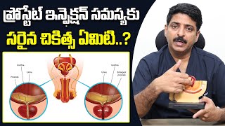 ప్రోస్టేట్ ఇన్ఫెక్షన్  Causes of Prostatitis in Telugu  Dr Rahul Reddy  ManamTv [upl. by Anillehs851]