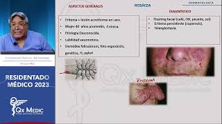 Dermatología  7 Rosácea [upl. by Halladba]