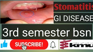 stomatitisGastrointestinal disease 1 stomatitisKMU BSN 3rd semester AHN types of stomatitis [upl. by Nidorf]