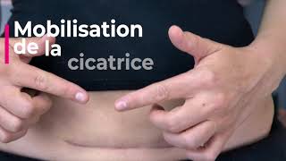 Automassage de votre cicatrice de césarienne  5 techniques de massage en temps réel Kiné Postpartum [upl. by Otilia]