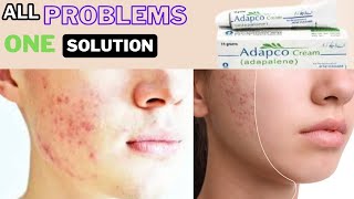 Adapco cream uses  solve all skin problems Honest reviews My first vedio on YouTube 🥺 [upl. by Riorsson776]