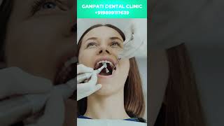 क्या दाँतों की सफाई करने से दाँत घिस जाते हैं  Does CleaningSCALING damage teeth teethcleaning [upl. by Damal62]