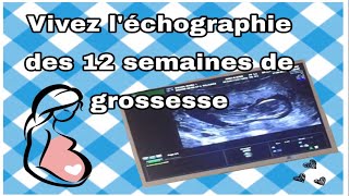 Comment se passe la Première Echographie détaillée des 12 semaines Ma Grossesse [upl. by Ennahoj]