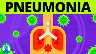 Pneumonia Overview  Causes Symptoms Diagnosis and Treatment [upl. by Eednyl]