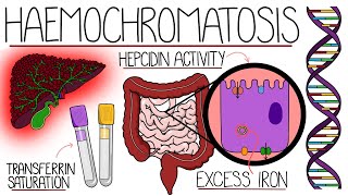 Understanding Haemochromatosis Hereditary amp Secondary [upl. by Onej]