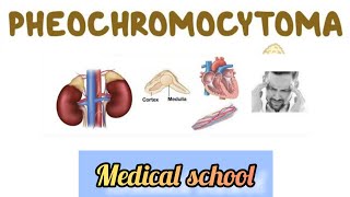 Pheochromocytoma خلاصة ال [upl. by Zelikow484]