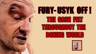 Tyson Fury vs Oleksandr Usyk Postponed  Quick Thoughts on the Cut [upl. by Enilreug]