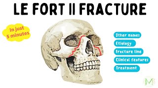 Le Fort II Fracture  Made easy in 5 Minutes  Medinare [upl. by Annoeik484]