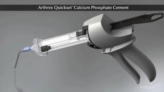 Arthrex Quickset™ Calcium Phosphate Cement [upl. by Warenne262]