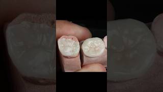 Maquillaje Disilicato de Litio aidite dientes esteticadental [upl. by Llewellyn]