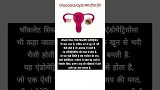 Whats a chocolate Cyst healthfacts amazingfacts health womenhealth gynae endometriosis [upl. by Ransom]