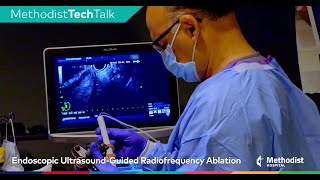 How It Works Endoscopic UltrasoundGuided Radiofrequency Ablation EUSRA [upl. by Atsirak]