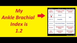 Do you know your Ankle Brachial Index [upl. by Halyak]