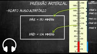 Pressão arterial  Hiato auscultatório e pulsações até 0 mmhg [upl. by Eelyram17]