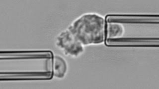 Chemotaxis and phagocytosis by a neutrophil encountering zymosan [upl. by Nommad]