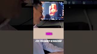 Crying in dad issues 😩 pregnancyannouncement babyultrasound bebe [upl. by Nirtiac]