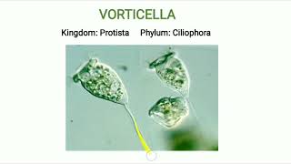 Phylum Ciliophora  Vorticella [upl. by Stephanus76]