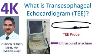 What is Transesophageal Echocardiogram TEE [upl. by Aikkan285]