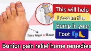 Bunion pain relief home remedies [upl. by Beulah]