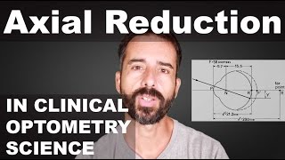 Adult Reduction In Eyeball Axial Length  Emmetropization Mechanism  EM  Reduced Lens Method ™ [upl. by Gershon]