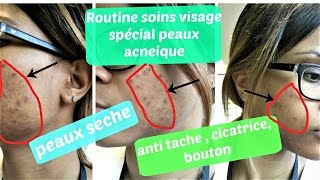 ROUTINE SOINS VISAGE special peaux acnéique tache cicatrice bouton lifestyle from taina [upl. by Assirral]