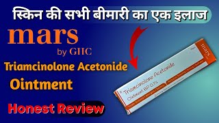 Triamcinolone Acetonide Ointment  Contact Dermatitis  Psoriasis Disease Treatment  Mars By GHC [upl. by Noraha]