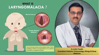 Laryngomalcia Stridor Symptoms Diagnosis amp Treatment I Dr Ankit Parakh Child Pulmonologist [upl. by Chadwick]