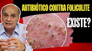 EXISTE ANTIBIÓTICO CONTRA FOLICULITE  DESCUBRA [upl. by Meier]