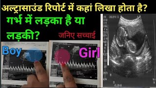 Ultrasound se jane Ladka ya ladki baby boy symptoms during pregnancy symptoms of baby boy babygender [upl. by Eeltrebor292]