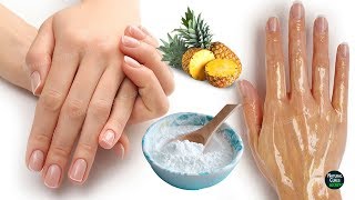 How To Remove Wrinkles From Hands Naturally in 2 Days [upl. by Dihaz]