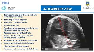 Fetal Heart Examination  Continuation [upl. by Ahsieuqal]