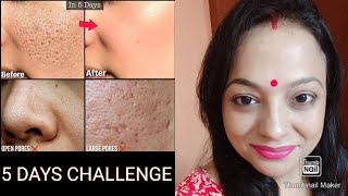 Get glowing amp Spotless SKIN At Home In Just 5 Days  RICE POWDER CHALLENGE bengalivlogskincare [upl. by Arlina]