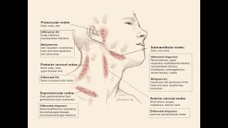 lymphadenopathy by Prof Dr Galal Abouelnagah [upl. by Ecar92]