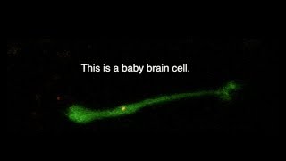 Watch a Baby Neuron Crawl its Way Along a Brain [upl. by Minton]