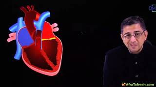 Cardiology Mitral Valve Prolapse with animation medicaleducation [upl. by Erskine]